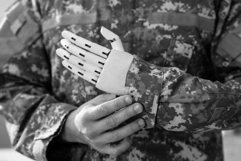Изображение военного с косметическим протезом